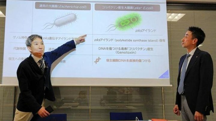 大腸がん 毒素作る腸内細菌が関与してるらしいで